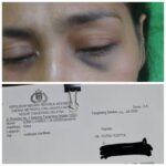 Diduga Kejam Dan Sadis Oknum Pegawai PPPK Lakukan KDRT Terhadap Istri Bertahun-tahun